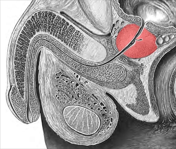 Anatomical cross-section drawing of the male pelvis with the prostate highlighted in red