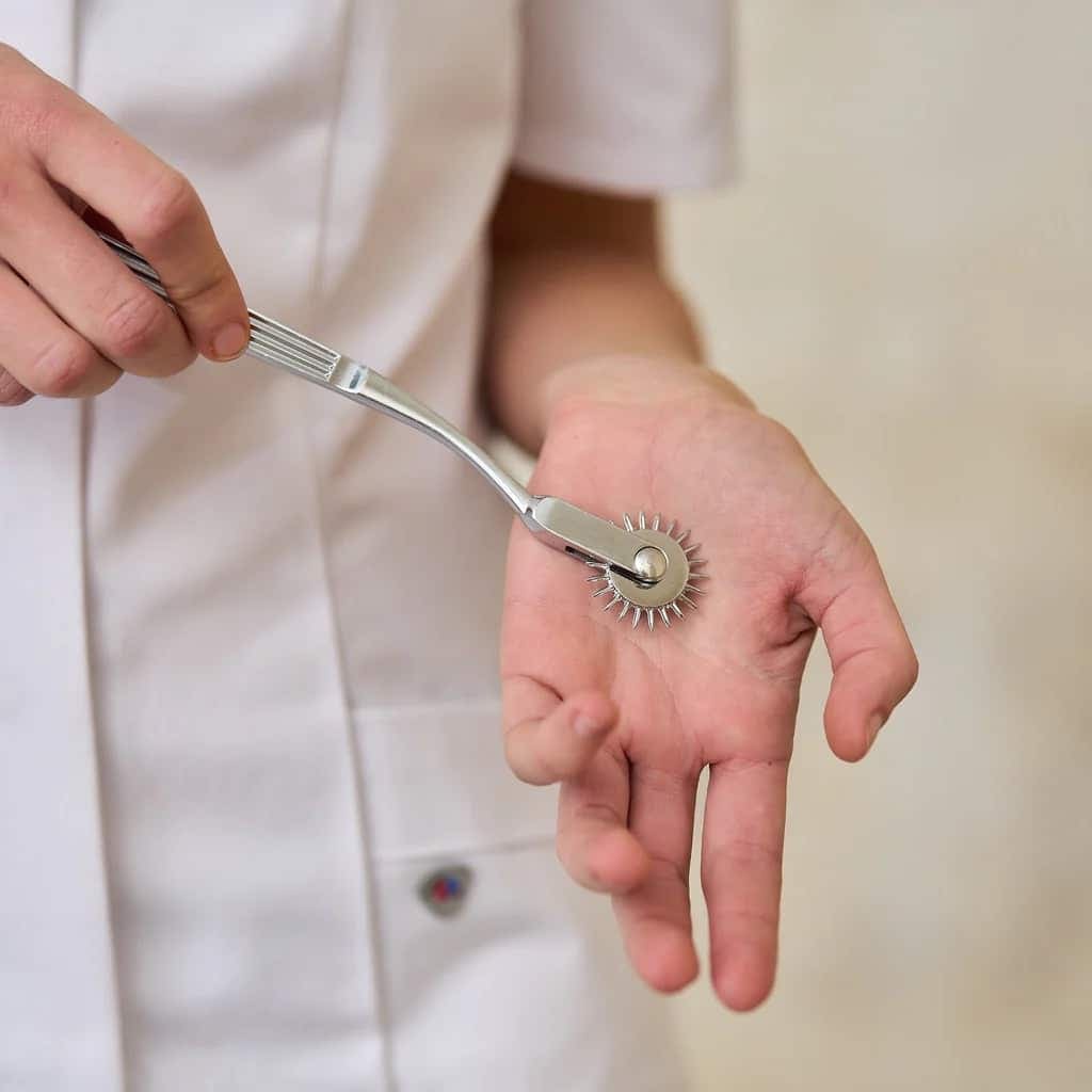 Person in a white coat running a Wartenberg wheel across another person's open palm